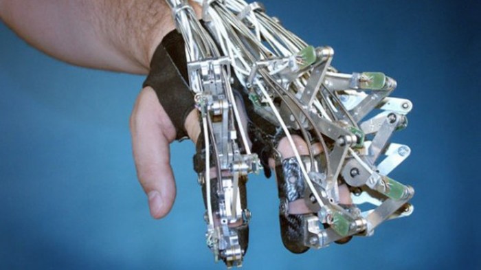 جهاز كمبيوتر عاقل يتحكم في أطراف اصطناعية