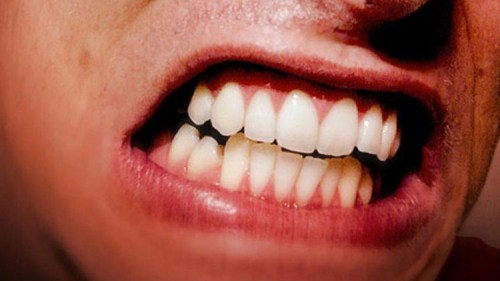 الجز علي الأسنان من العوامل التي ستجعلك تقوم من النوم متعبا