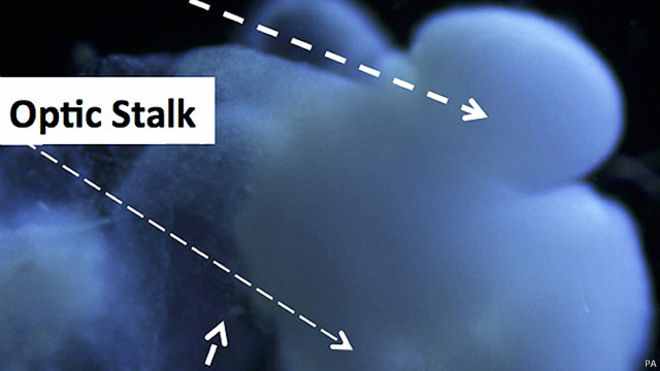 الدماغ المصنع يحتوي على خلايا عصبية ومناعية بالإضافة إلى 99٪ من الجينات الموجودة في دماغ الجنين 