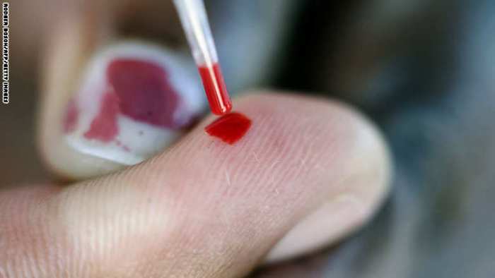 فقر الدم ليس مرضا