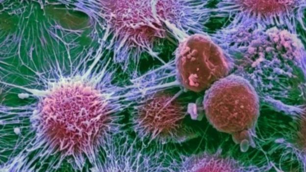 الأورام السرطانية تقلصت بنسبة 31% عند استخدام علاجات دقيقة تستهدف الطفرات التي تساعد الورم على تطوير قدراته