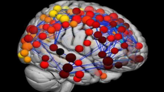 أظهرت عمليات مسح الدماغ ضوئيا أن أكثر المناطق تغيرا في سنوات المراهقة هي تلك المرتبطة بعمليات التفكير المعقدة