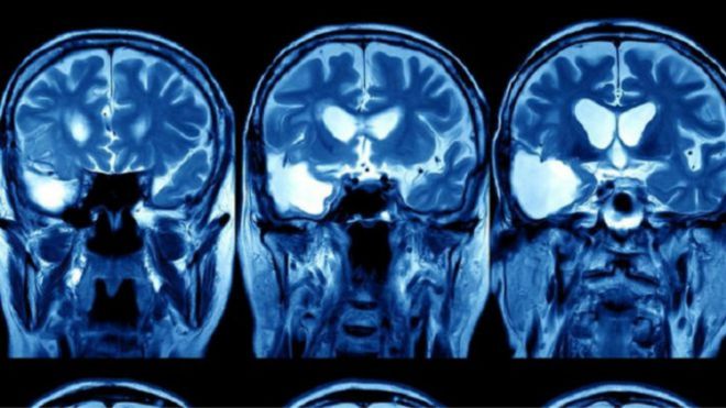 يستخدم نظام "Deep Mind" من جوجل لتحليل صور الأشعة