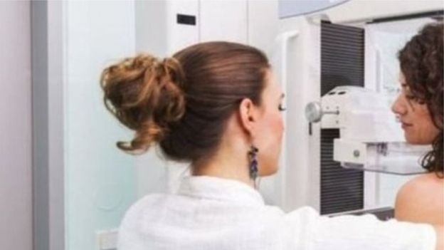 الذكاء الاصطناعي تفوق على أطباء متمرسين في تشخيص سرطان الثدي