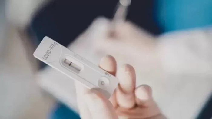 توفي أكثر من 5.5 مليون شخص حول العالم بسبب كوفيد ، وفقاً لمركز فيروس كورونا بجامعة جونز هوبكنز