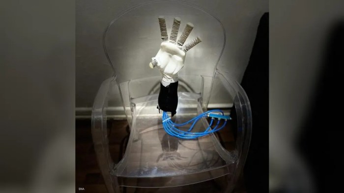 يعتمد الطرف الصناعي على إشارات المخ