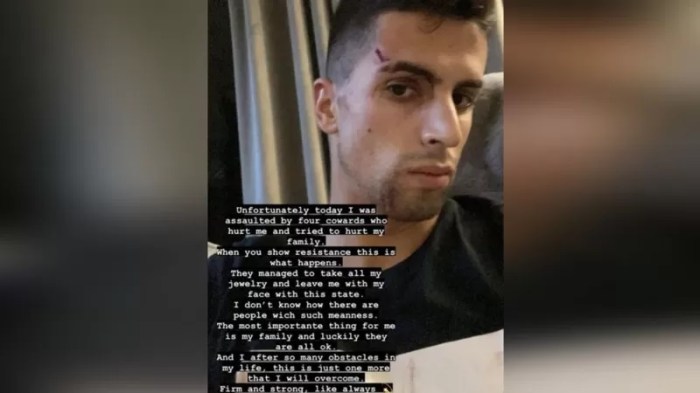 اللاعب كانسيلو أصيب أثناء التصدي للصوص حاولوا اقتحام منزله