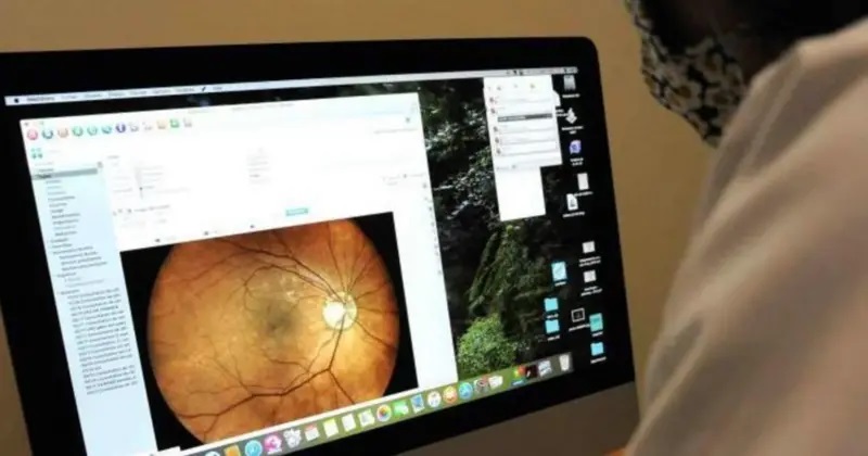 يمكن تدريب الذكاء الاصطناعي على فحص صور قاع العين - الجدار الخلفي للعين